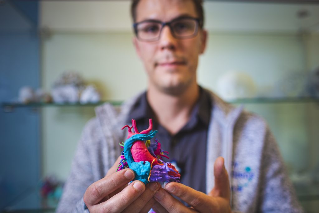 Dr. Justin Ryan, holding a 3D printed model of a patient's heart.